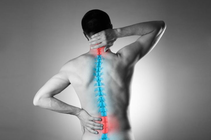 Lombalgia e lombosciatalgia: quando il mal di schiena è un problema