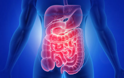 Colon irritabile (Irritable Bowel Syndrome – IBS)